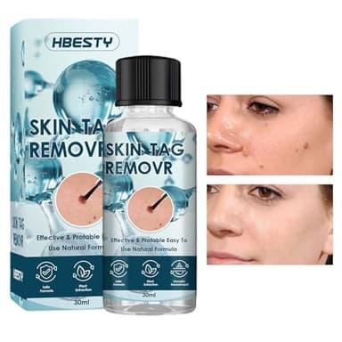 30ml Esencia Para Verrugas | Líquido Para Eliminar Verrugas | De Nitrógeno Líquido Antiverrugas | Eliminador De Marcas En La Piel | Piel Y Líquido Reparador | Eliminación Natural De Lunares