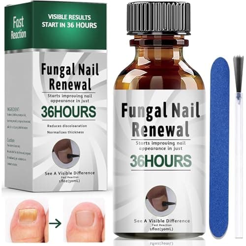 30ML Bolígrafos para Reparadores de Uñas Solución+ Lima de Uñas Gratis, Solución para hongos y micosis, uñas frágilizadas y dañadas, cuidado de uñas, Cuidado para dedos y pedicura